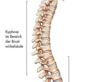 Rückenschmerzen und ihre Ursachen