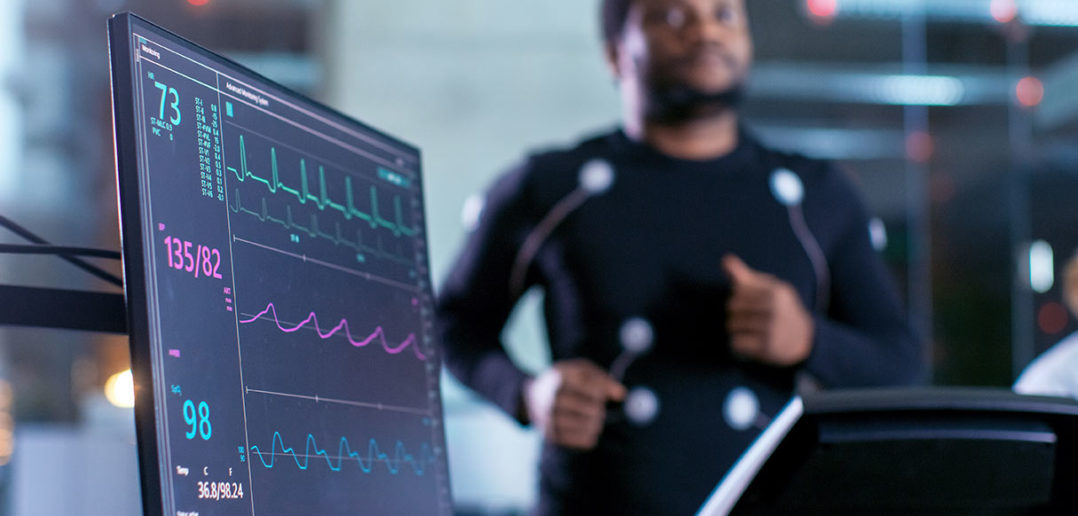 TRIMP: Die Messung der Trainingsbelastung