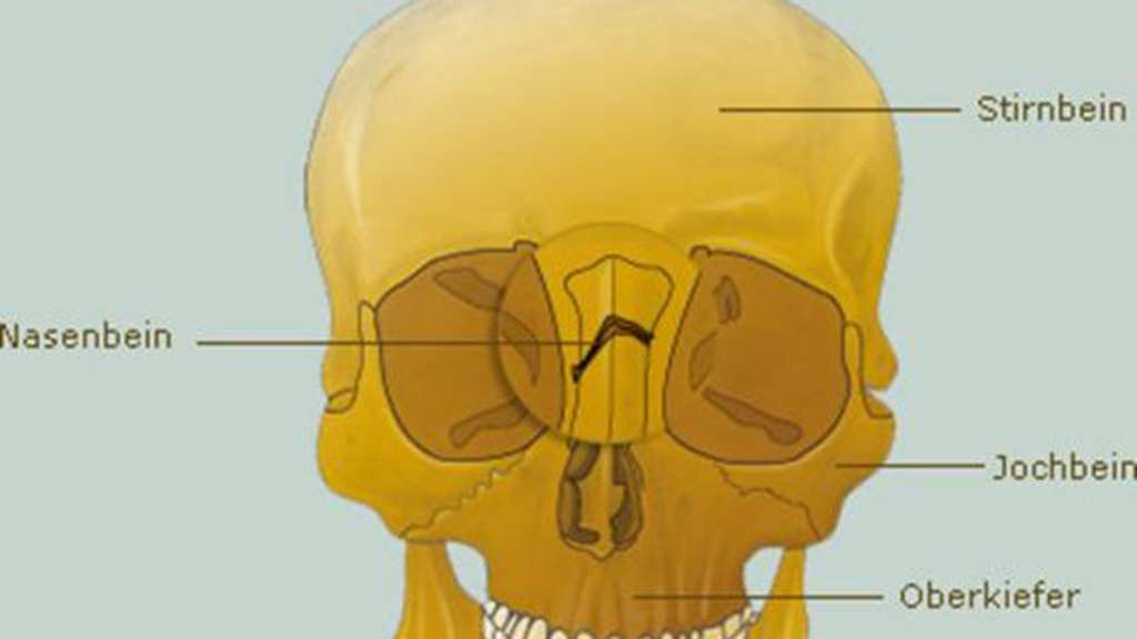 Die Anatomie Der Nase Und Mittelgesichtsknochen C Www Sportschau De Trainingsworld Das Sportexperten Portal
