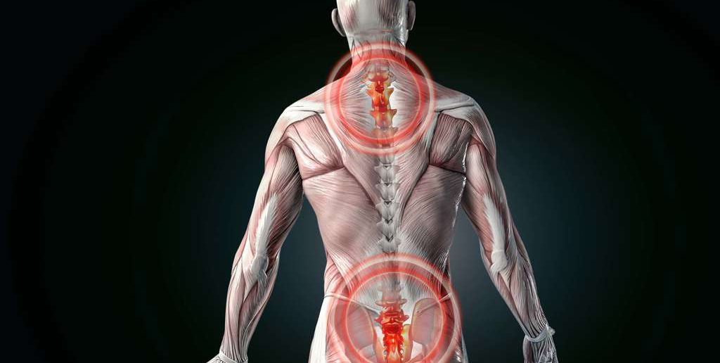 Was hilft gegen Rückenschmerzen: mit diesen Übungen schmerzfrei werden