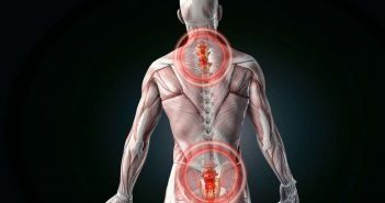 Bewegungstherapie und Training bei Rückenschmerzen Was hilft gegen Rückenschmerzen: mit diesen Übungen schmerzfrei werden