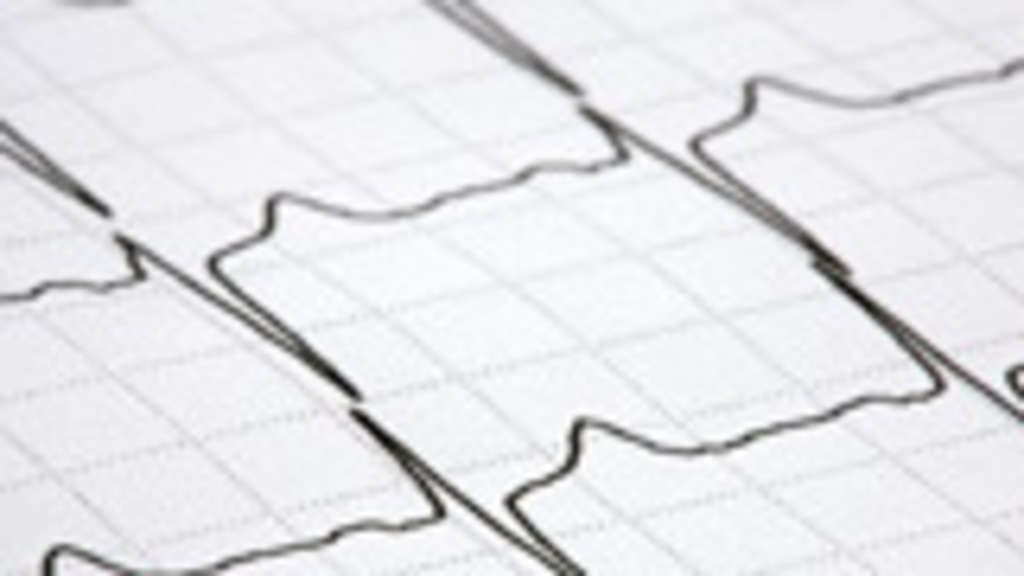 SEARCH AND BUY THIS PRODUCT Verursachen Anabolika wirklich Herzschäden? | Sportmedizin