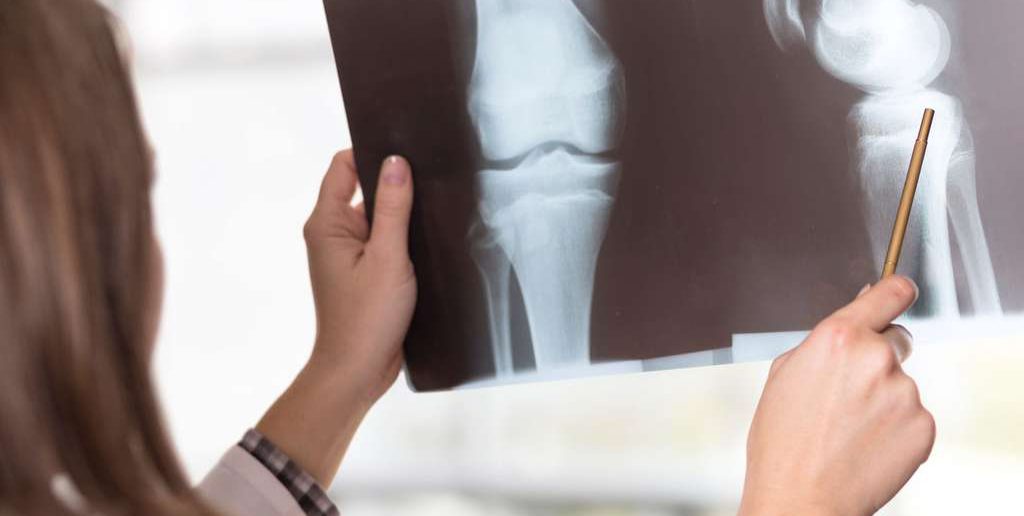 Knieschmerzen nach dem Laufen: Ursache, Symptome, Übungen, Behandlung, Vorbeugung