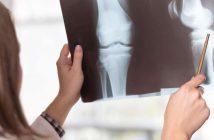 Knieschmerzen nach dem Laufen: Ursache, Symptome, Übungen, Behandlung, Vorbeugung
