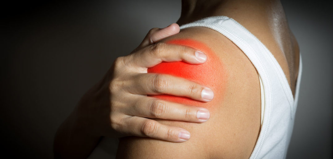 Entzündung der Supraspinatussehne: Ursache, Symptome, Therapie, Hilfe