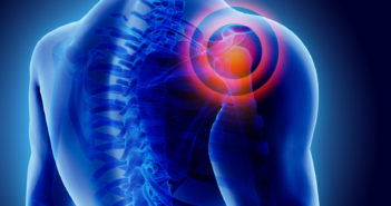 Schmerzen in der Schulter? Drei effektive Übungen gegen das Schulter-Impingement Schmerzen in der Schulter