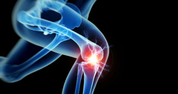 Weihrauch gegen Arthrose und Gelenkschmerzen? was hilft gegen Gelenkschmerzen