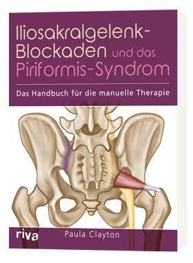 Iliosakralgelenk-Blockade, Schmerzen im unteren Rücken, Piriformis-Syndrom