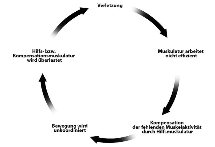 Schmerzen beim Sport: Teufelskreis der Kompensation