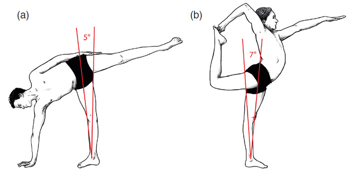Überstrecken des Kniegelenks: Erklärt anhand einer Grafik