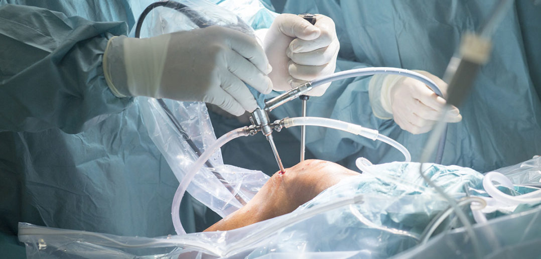 kreuzband op nach riss des vorderen kreuzbandes