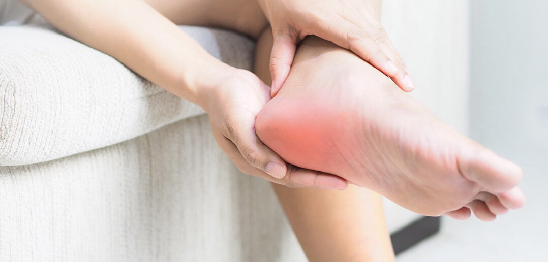 Welche Übungen bei Fersenschmerzen? diese übungen helfen bei fersensporn