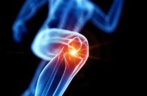 Knieprobleme - Die besten Übungen für ein gesundes Kniegelenk
