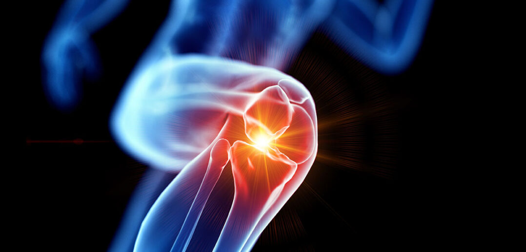 diese uebungen helfen bei knieschmerzen