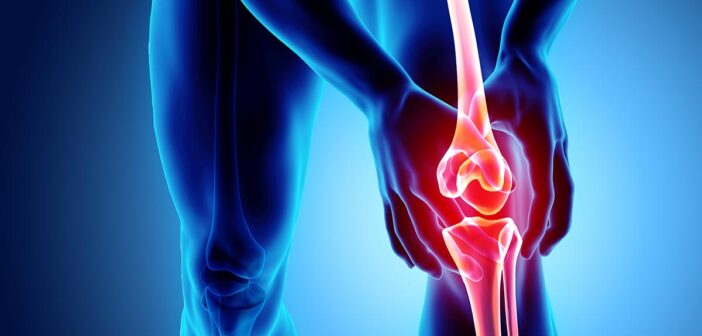 diese tipps und übungen helfen bei gonarthrose