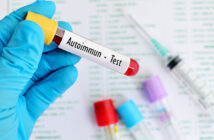 ratgeber: helfen sport und ernährung bei autoimmunerkrankungen?