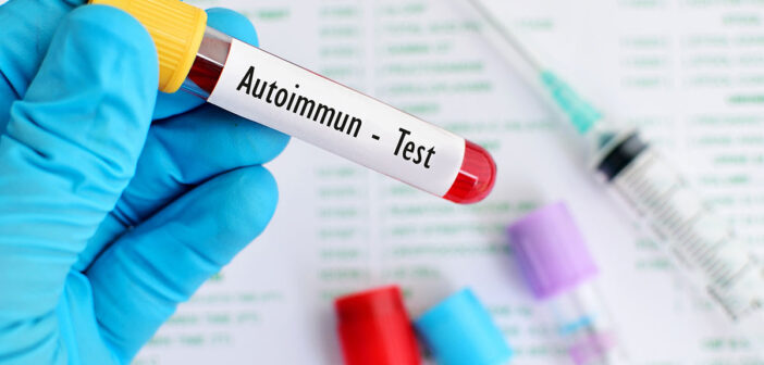 ratgeber: helfen sport und ernährung bei autoimmunerkrankungen?