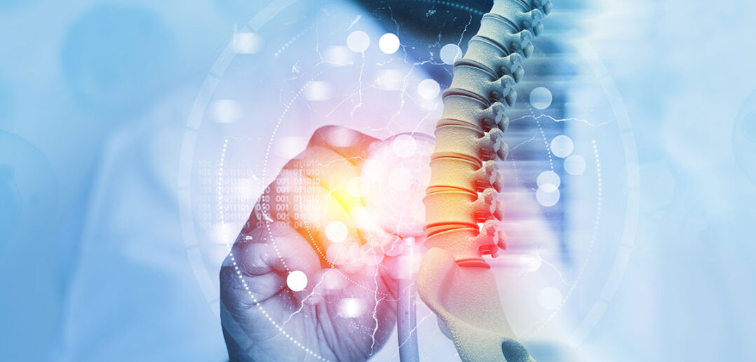 aktuelle studien zur behandlung von rückenschmerzen