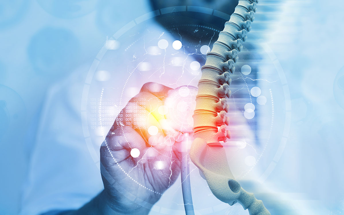 Chronische Rückenschmerzen: neue Studien zur Rehabilitation
