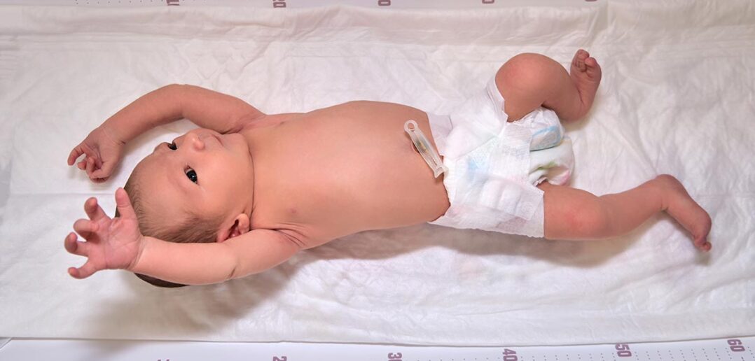 alles zum Thema Moro-Reflex