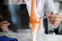 was tun gegen arthrose im knie