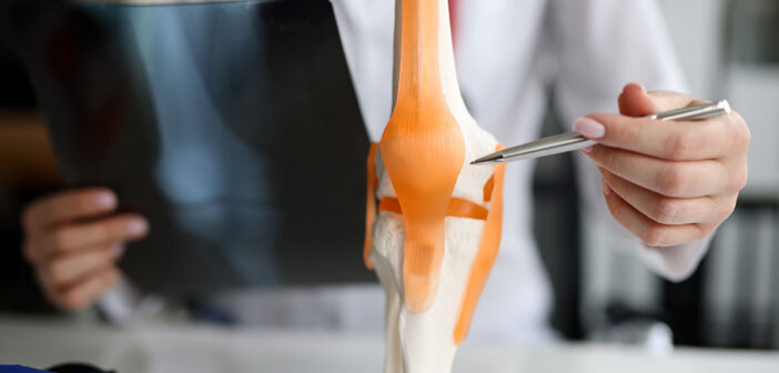 was tun gegen arthrose im knie