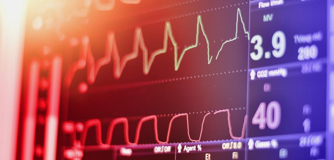Schlafstörungen, Herzfrequenzvariabilität und Stressmanagement